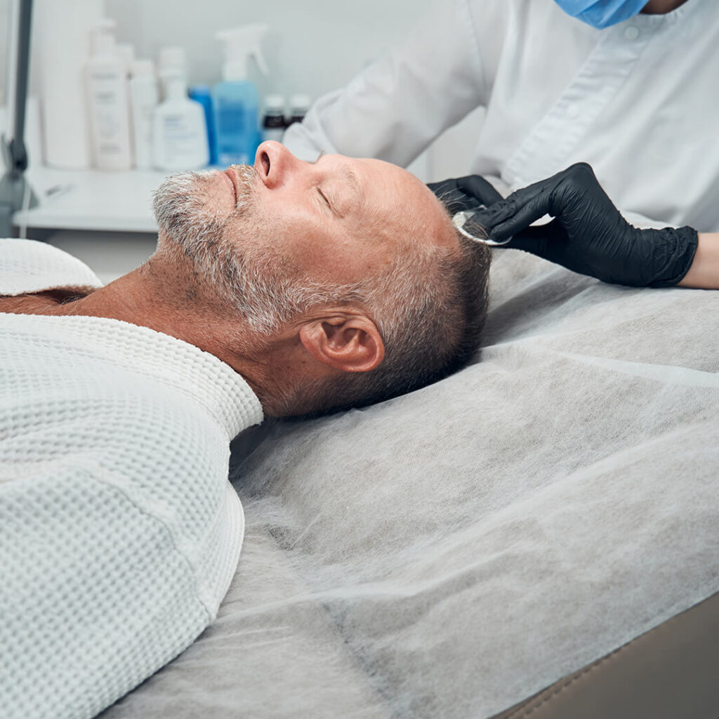 Man lying in bed receiving Stem Cell Treatment for Hair Loss, depicting an active step towards addressing and treating his hair loss condition.