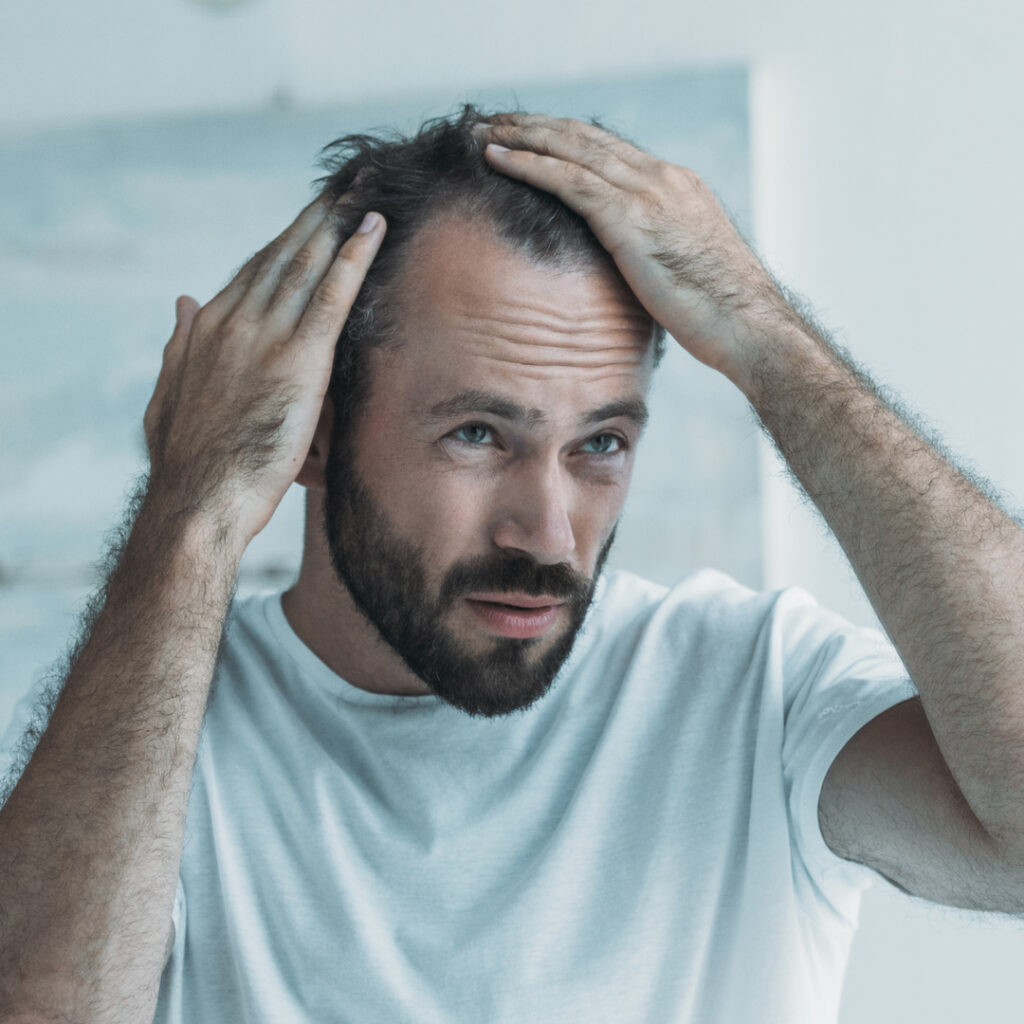 Man examining his hair in the mirror, spreading his hair to check for hair loss, symbolizing the search for a solution through Stem Cell Treatment for Hair Loss.